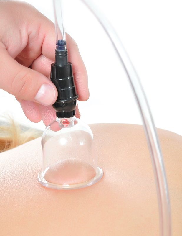 FETISH FANTASY SERIES - CUPPING SET ONDE STIMOLANTI 6 PEZZI